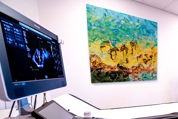 Carotisdoppler Kardiologie Garbsen